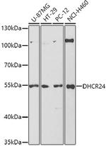 DHCR24 Antibody in Western Blot (WB)