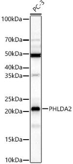 PHLDA2 Antibody in Western Blot (WB)