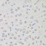 PENK Antibody in Immunohistochemistry (Paraffin) (IHC (P))