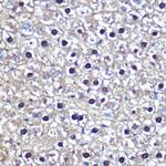 Transketolase Antibody in Immunohistochemistry (Paraffin) (IHC (P))