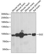 GLI2 Antibody in Western Blot (WB)