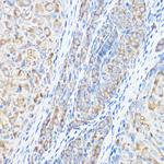 Seryl-tRNA synthetase Antibody in Immunohistochemistry (Paraffin) (IHC (P))