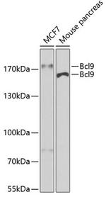BCL9 Antibody in Western Blot (WB)