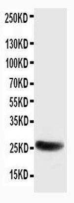 SNAP25 Antibody in Western Blot (WB)