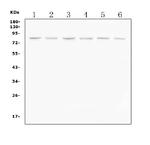 PI3K p85 alpha Antibody in Western Blot (WB)