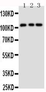 TRPC6 Antibody in Western Blot (WB)