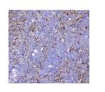 SQSTM1 Antibody in Immunohistochemistry (Paraffin) (IHC (P))