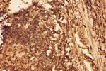 Cofilin Antibody in Immunohistochemistry (Paraffin) (IHC (P))