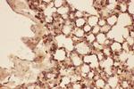 Cofilin Antibody in Immunohistochemistry (Paraffin) (IHC (P))