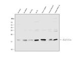 Cofilin Antibody in Western Blot (WB)