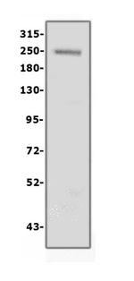 Collagen IV Antibody in Western Blot (WB)