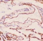 Collagen IV Antibody in Immunohistochemistry (Paraffin) (IHC (P))