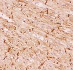 Desmin Antibody in Immunohistochemistry (Frozen) (IHC (F))