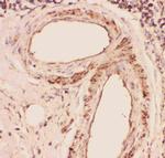 Desmin Antibody in Immunohistochemistry (Paraffin) (IHC (P))