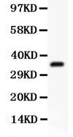 Desmin Antibody in Western Blot (WB)