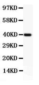 NFkB p52/p100 Antibody in Western Blot (WB)