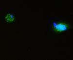 SQSTM1 Antibody in Immunocytochemistry (ICC/IF)