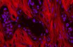 SQSTM1 Antibody in Immunohistochemistry (Paraffin) (IHC (P))