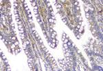 SQSTM1 Antibody in Immunohistochemistry (Paraffin) (IHC (P))