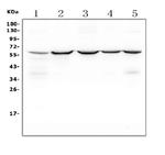 SQSTM1 Antibody in Western Blot (WB)