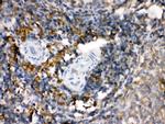 TGM2 Antibody in Immunohistochemistry (Paraffin) (IHC (P))