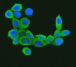 Cofilin Antibody in Immunocytochemistry (ICC/IF)