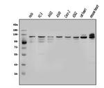 OGT Antibody in Western Blot (WB)