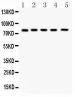 FSHR Antibody in Western Blot (WB)