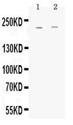 MRP1 Antibody in Western Blot (WB)