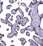 RAB6A Antibody in Immunohistochemistry (Paraffin) (IHC (P))