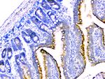 DDR2 Antibody in Immunohistochemistry (Paraffin) (IHC (P))