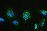 HAS1 Antibody in Immunocytochemistry (ICC/IF)