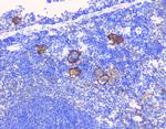 CD229 Antibody in Immunohistochemistry (Paraffin) (IHC (P))