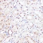 BRD2 Antibody in Immunohistochemistry (Paraffin) (IHC (P))