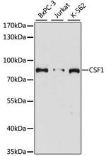 M-CSF Antibody in Western Blot (WB)