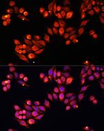 HPa1 Antibody in Immunocytochemistry (ICC/IF)