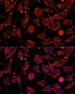 ITSN2 Antibody in Immunocytochemistry (ICC/IF)