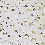 GRK2 Antibody in Immunohistochemistry (Paraffin) (IHC (P))