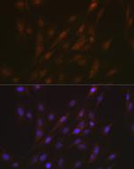 PYCARD Antibody in Immunocytochemistry (ICC/IF)