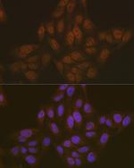 PYCARD Antibody in Immunocytochemistry (ICC/IF)