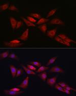 NOTCH1 Antibody in Immunocytochemistry (ICC/IF)