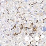 CD38 Antibody in Immunohistochemistry (Paraffin) (IHC (P))