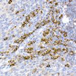 CD38 Antibody in Immunohistochemistry (Paraffin) (IHC (P))