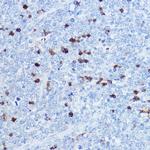 S100A8 Antibody in Immunohistochemistry (Paraffin) (IHC (P))