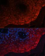 S100A8 Antibody in Immunohistochemistry (Paraffin) (IHC (P))