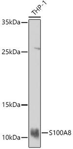 S100A8 Antibody in Western Blot (WB)