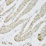 CD9 Antibody in Immunohistochemistry (Paraffin) (IHC (P))