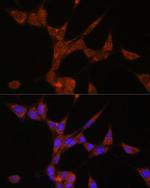 AKR1C3 Antibody in Immunocytochemistry (ICC/IF)