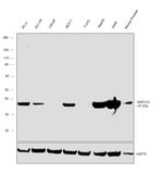 AKR1C3 Antibody