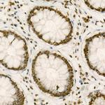 PTBP1 Antibody in Immunohistochemistry (Paraffin) (IHC (P))